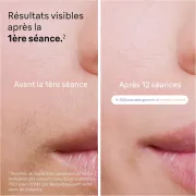 Image : Braun skin i-expert pro PL7253 épilateur